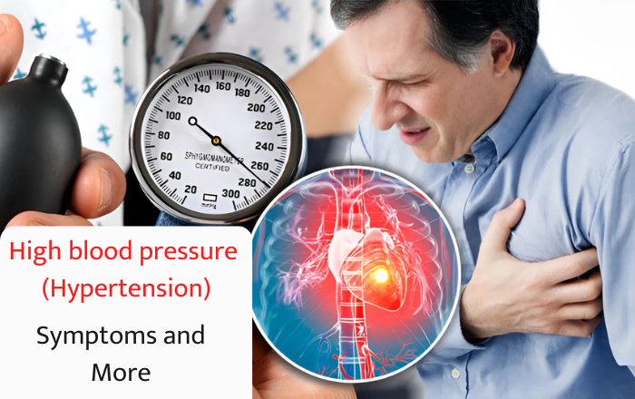 High blood pressure (hypertension): Symptoms and More